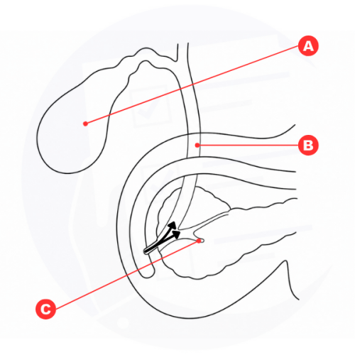 Dettaglio di colecisti/cistifellea (A), dotto biliare principale (B) e accesso strumentale alle vie biliari e al dotto pancreati Dettaglio di colecisti/cistifellea (A), dotto biliare principale (B) e accesso strumentale alle vie biliari e al dotto pancreati