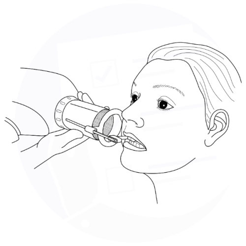 Radiografia bitewing - modulo di consenso informato | www.consavio.com