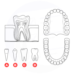 2 PREMIUM GRADO DENTALE INFERIORE + CHIRURGIA RADICE SUPERIORE - Foto 6