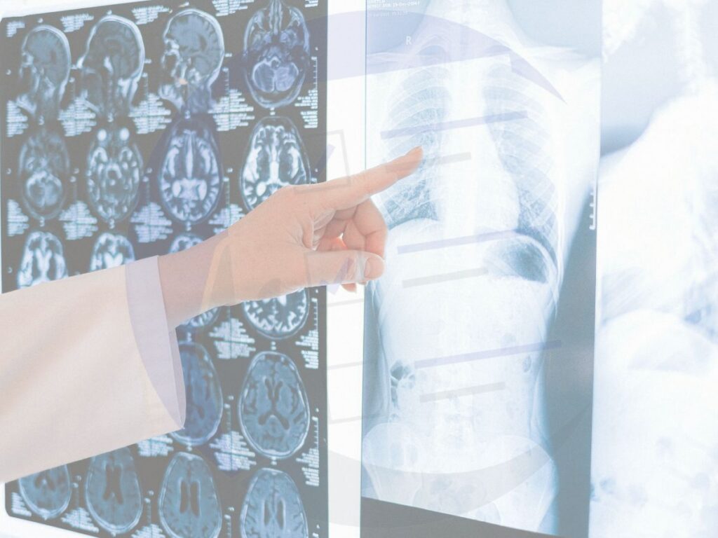 Consenso informato radiologia